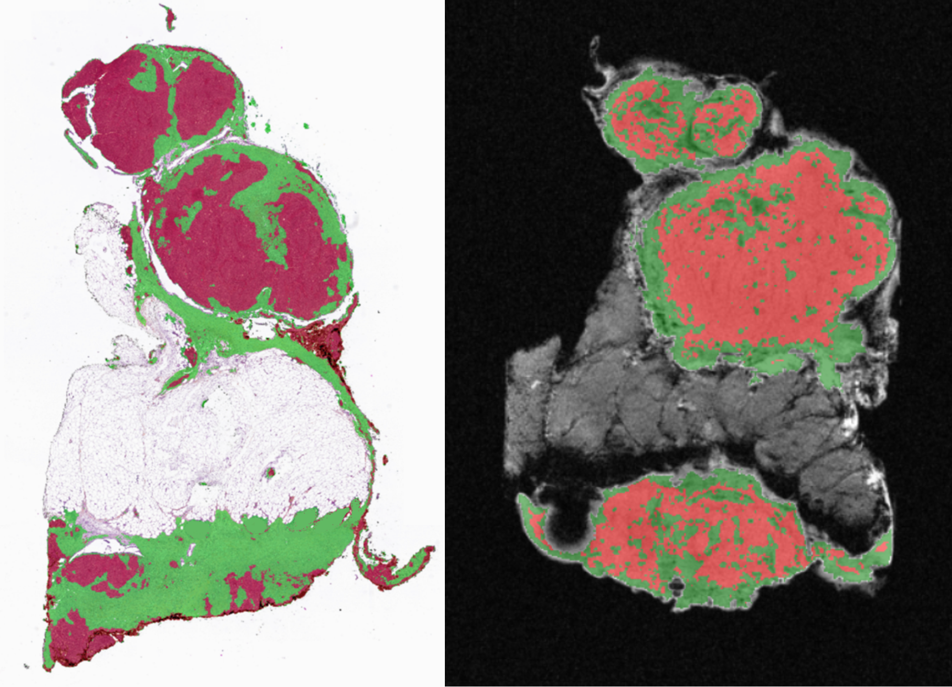 Virtual Biopsies Example